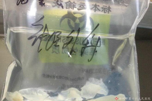 什么是脑囊虫病？