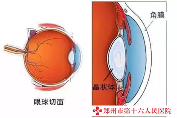 白内障病发原因是什么？能医治吗？