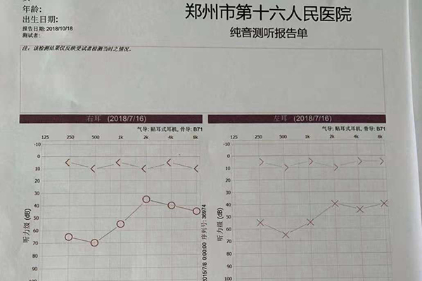 术前检查听力受损严重