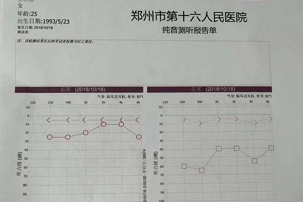 术后复查听力恢复正常