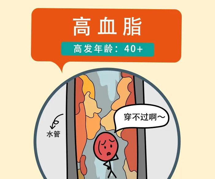 高血脂，高发年龄：40+