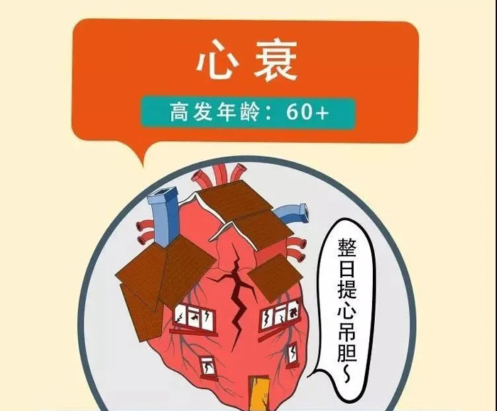 心衰，高发年龄：60+