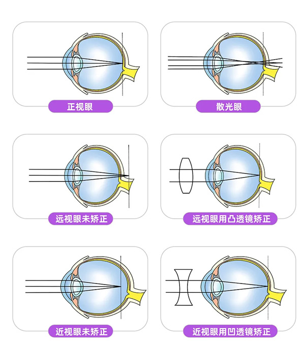 0-6岁儿童眼保健有多重要？