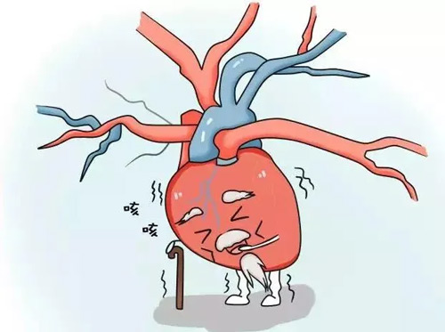 5种信号提示心肌梗死发作 10个时段需要格外警惕