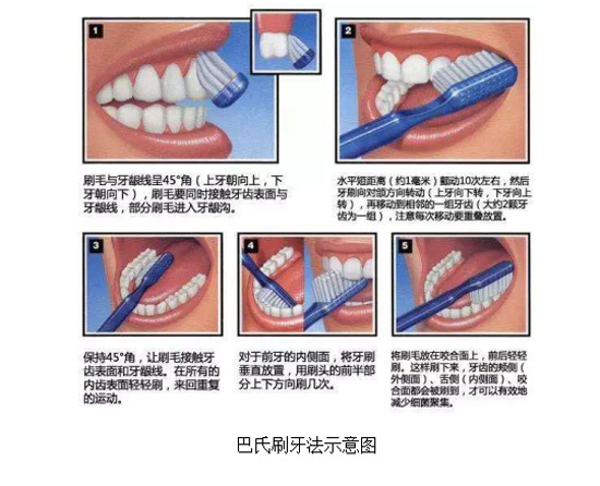 蛀牙真的是牙被虫蛀了吗？