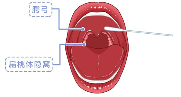 疾控专家告诉你核酸检测为什么要采口鼻不能采耳？