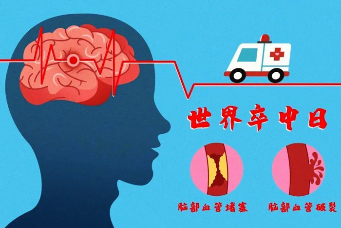 10月29日世界卒中日|分秒“B”争，救治大脑