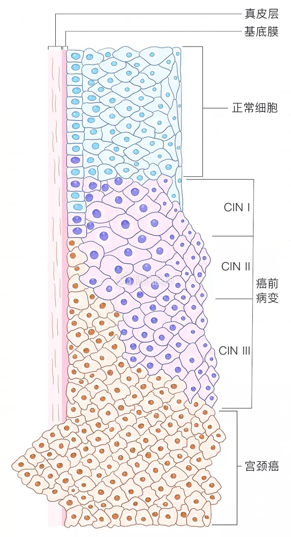 “活检”是什么？怎么做？