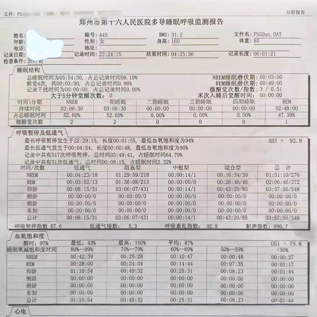 打呼噜通过什么检查可以明确类型？