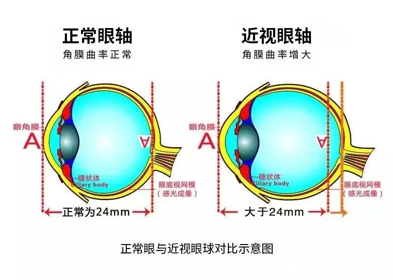 “视”不宜迟！别让所谓的“假性近视”耽误了孩子！