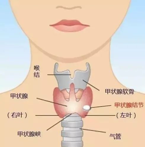 甲状腺癌冲上“热搜”！是良是恶？一针见分晓！